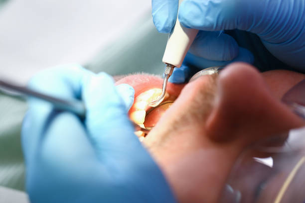 Best Emergency Dental Extractions in Baldwin, MI