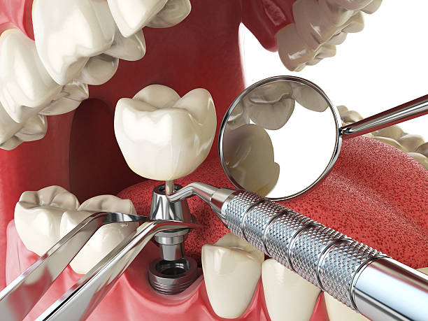 Best Emergency Dental Services for Seniors in Baldwin, MI